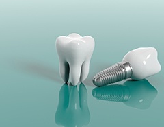 model of a real tooth next to a dental implant 