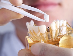 dentist placing a crown onto a dental implant model 
