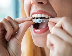 Closeup of patient putting on clear aligner