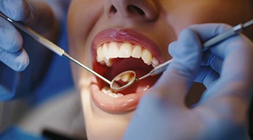Dentist examining a patient’s teeth with small mirror
