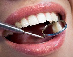 Closeup of smile during dental exam