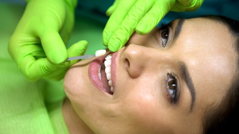 Woman with porcelain veneers