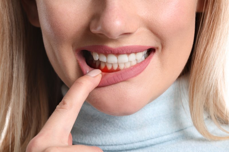 woman with gum disease in Newark pointing to her gums