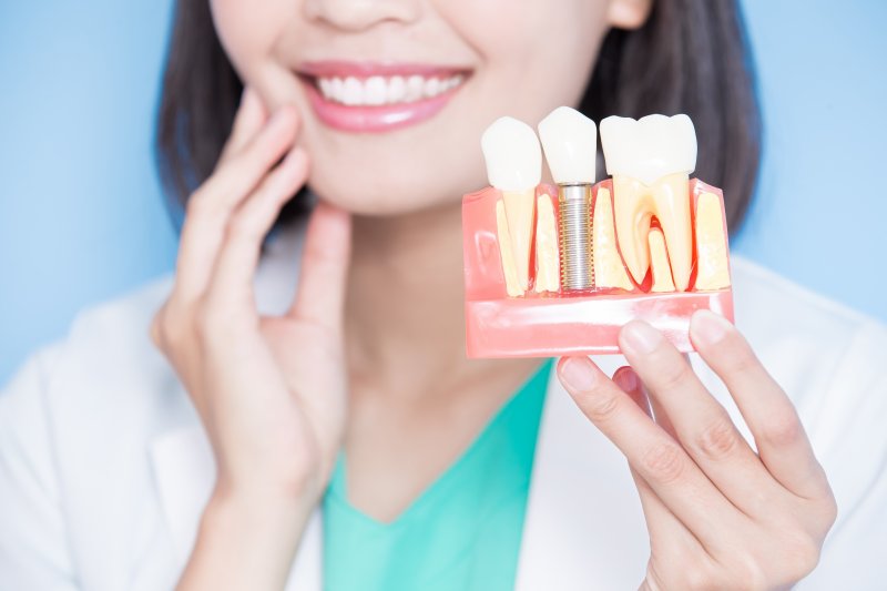 A dentist holding a model of dental implants in Newark