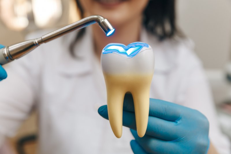 3-D model of a dental filling