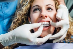 Middle-aged woman getting Invisalign.